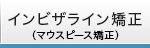 インビザライン矯正